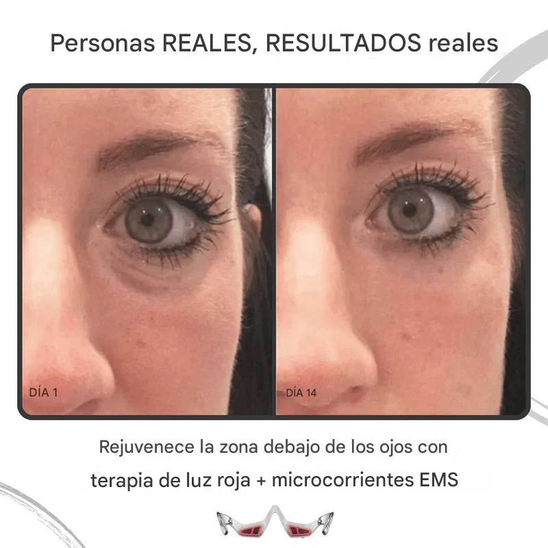 Terapia ocular 3D con luz roja antiedad - VELIROTerapia ocular 3D con luz roja antiedadVELIROVELIROTerapia ocular 3D con luz roja antiedad